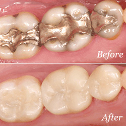 Before and After