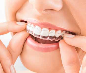 Dr. Bingham-Lester Vickii at Bingham - Lester Dentistry explains how to keep their invisible braces clear