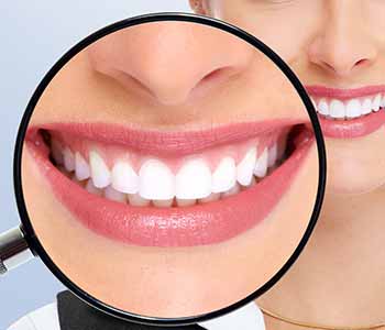 Dr. Bingham-Lester Vickii at Bingham-Lester Dentistry offers a teeth whitening procedure using KöR deep bleaching.