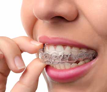 Dr. Bingham-Lester helps her Gambrills, MD, patients understand how effective Invisalign braces are