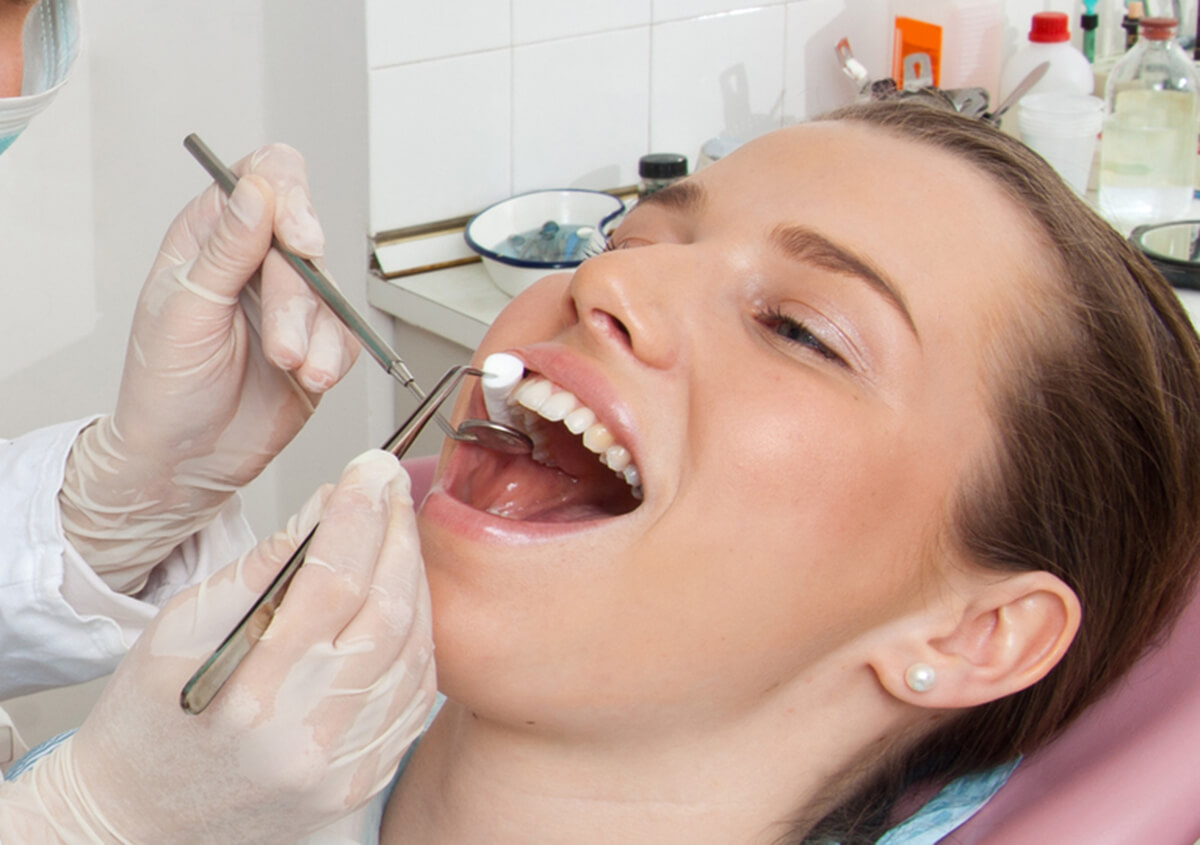 How Composite Fillings Outperform Dental Amalgam in Gambrills MD Area