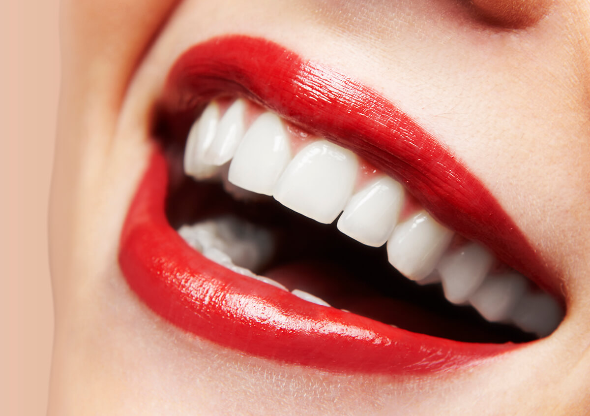 Need A Radiant Smile? Come for the Safest Teeth Whitening Methods in Gambrills, MD Area