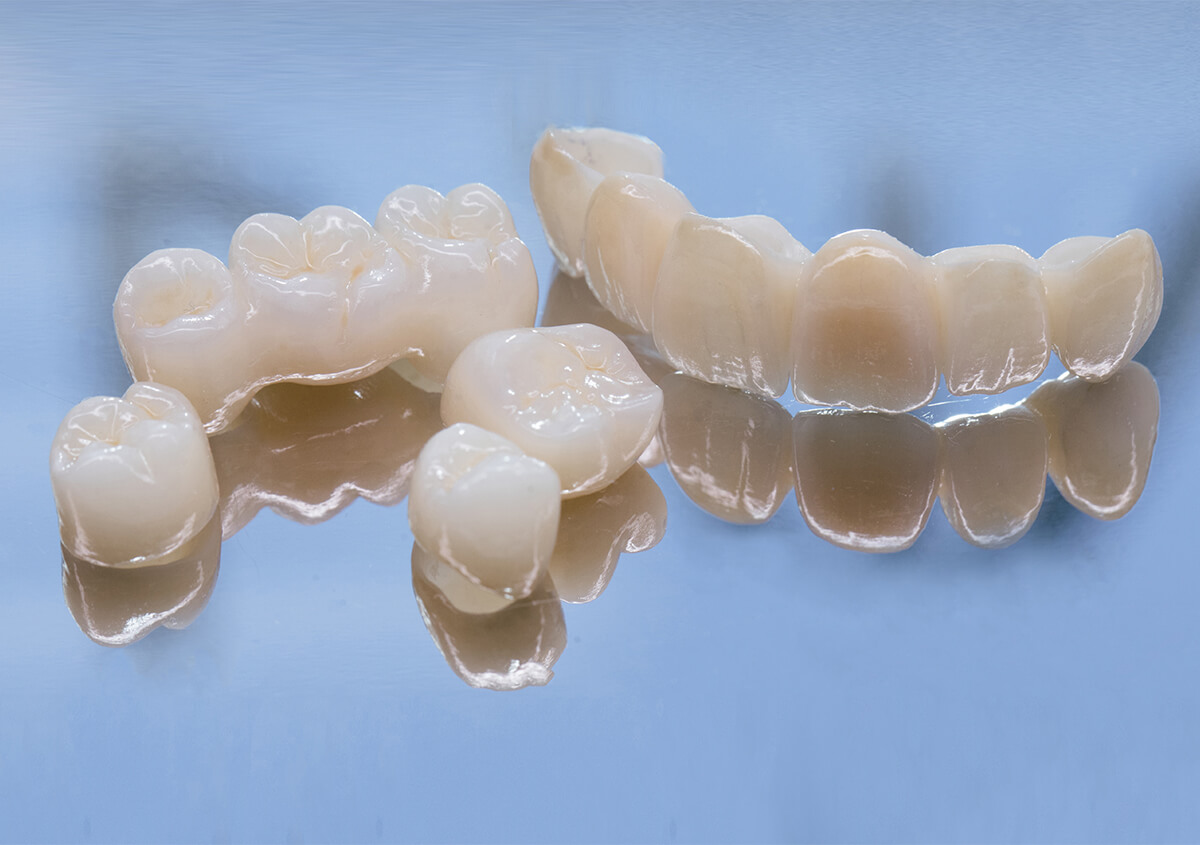 Natural-Looking Dental Crown in Crofton MD Area