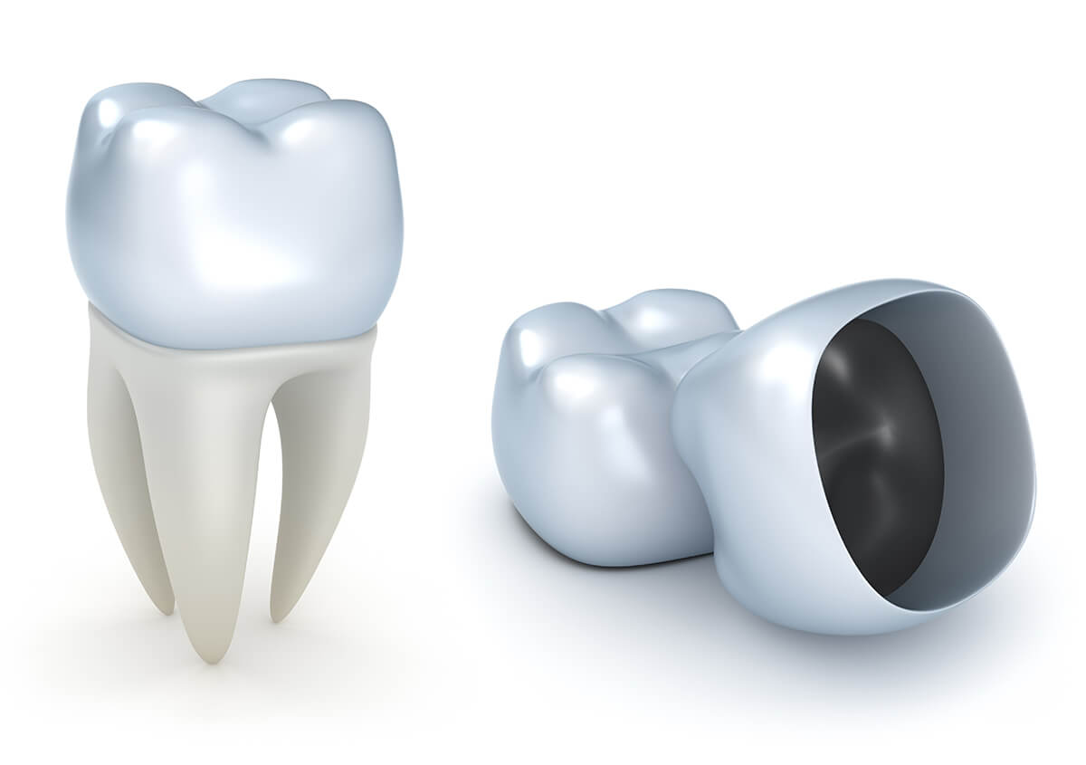 Benefits of Porcelain Crowns in Crofton MD Area