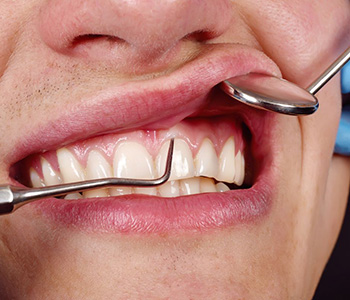 Proactive periodontal procedures in Gambrills and Crofton, MD: For the long, healthy life of your smile